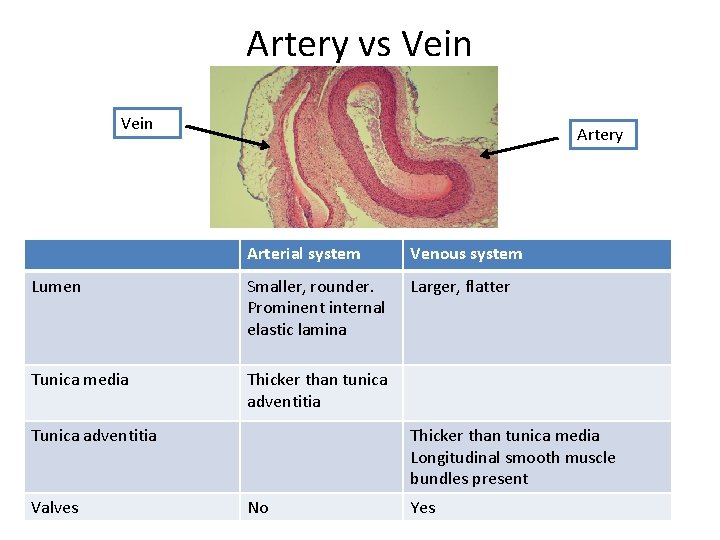 Artery vs Vein Artery Arterial system Venous system Lumen Smaller, rounder. Prominent internal elastic
