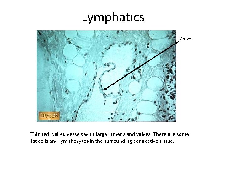 Lymphatics Valve Thinned walled vessels with large lumens and valves. There are some fat