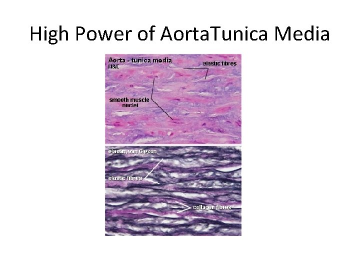 High Power of Aorta. Tunica Media 