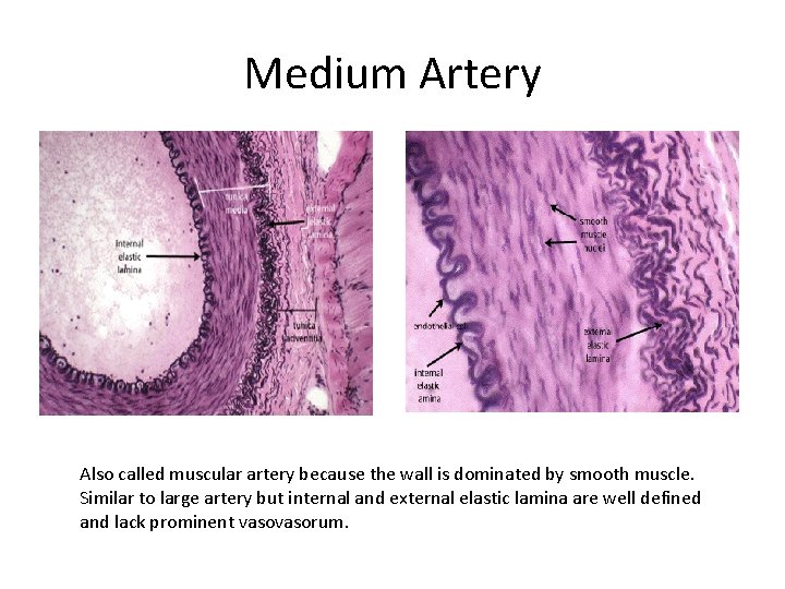 Medium Artery Also called muscular artery because the wall is dominated by smooth muscle.