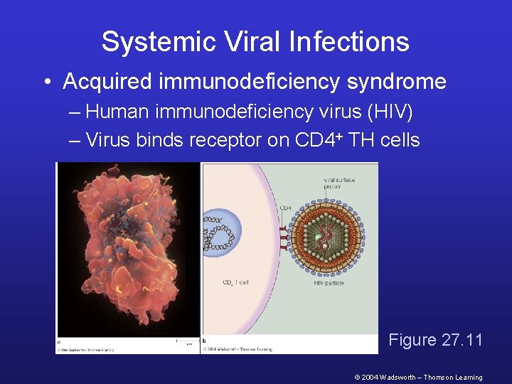 Systemic Viral Infections • Acquired immunodeficiency syndrome – Human immunodeficiency virus (HIV) – Virus