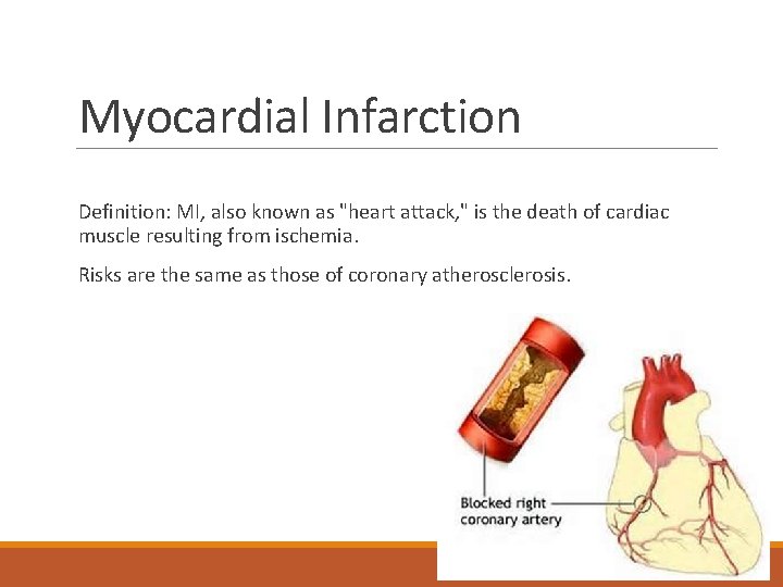 Myocardial Infarction Definition: MI, also known as "heart attack, " is the death of