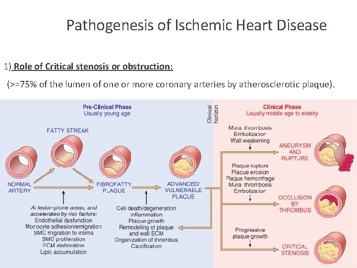 Pathogenesis of Ischemic Heart Disease 1) Role of Critical stenosis or obstruction: (>=75% of