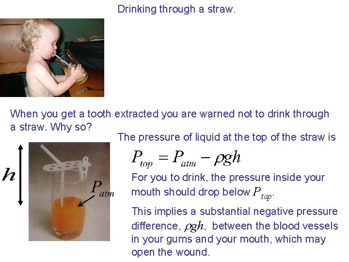Drinking through a straw. When you get a tooth extracted you are warned not Drinking through a straw. When you get a tooth extracted you are warned not