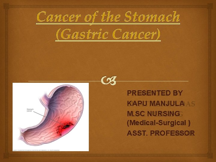PRESENTED BY KAPU MANJULA M. SC NURSING (Medical-Surgical ) ASST. PROFESSOR 