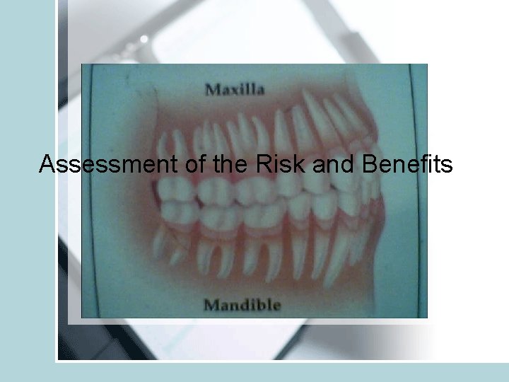 Assessment of the Risk and Benefits 