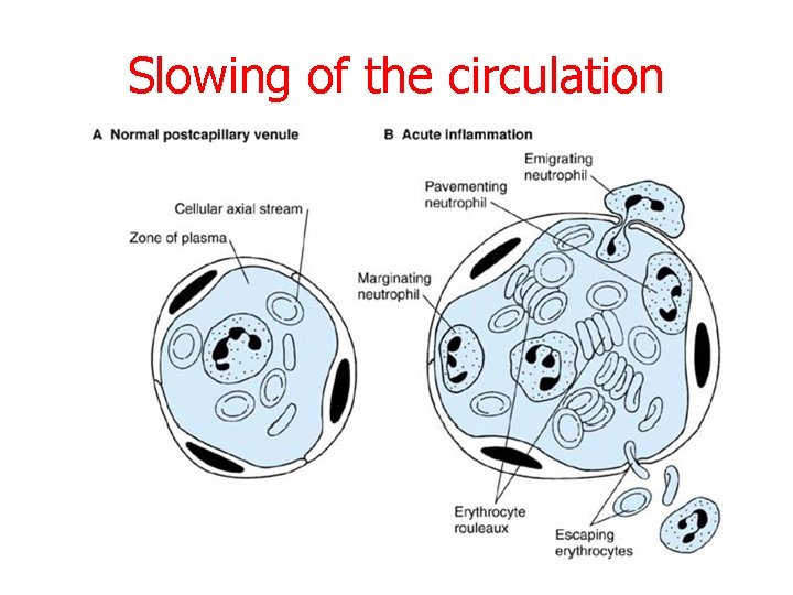 Slowing of the circulation 
