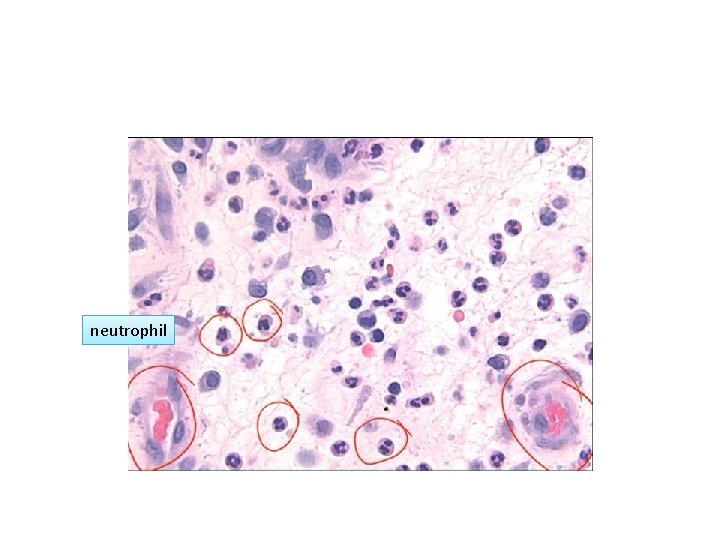 neutrophil 