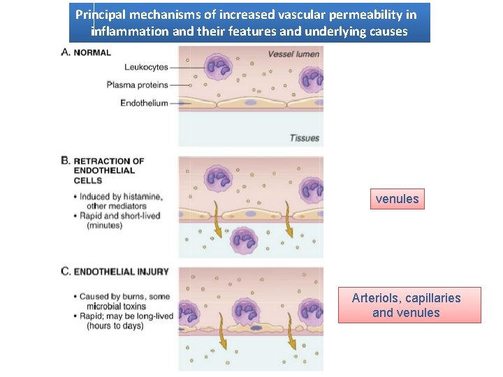 Principal mechanisms of increased vascular permeability in inflammation and their features and underlying causes