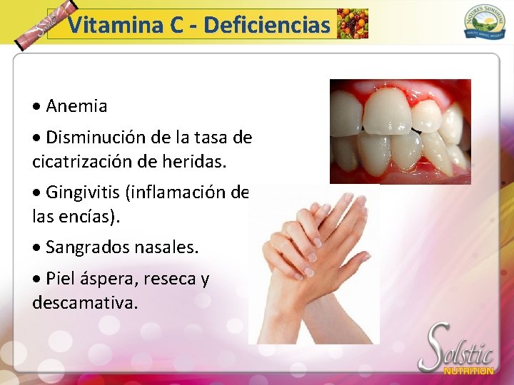 Vitamina C - Deficiencias · Anemia · Disminución de la tasa de cicatrización de