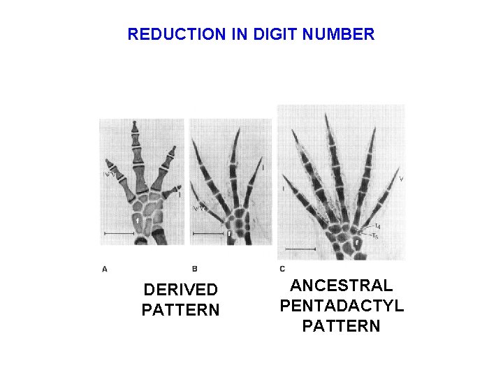 REDUCTION IN DIGIT NUMBER DERIVED PATTERN ANCESTRAL PENTADACTYL PATTERN 