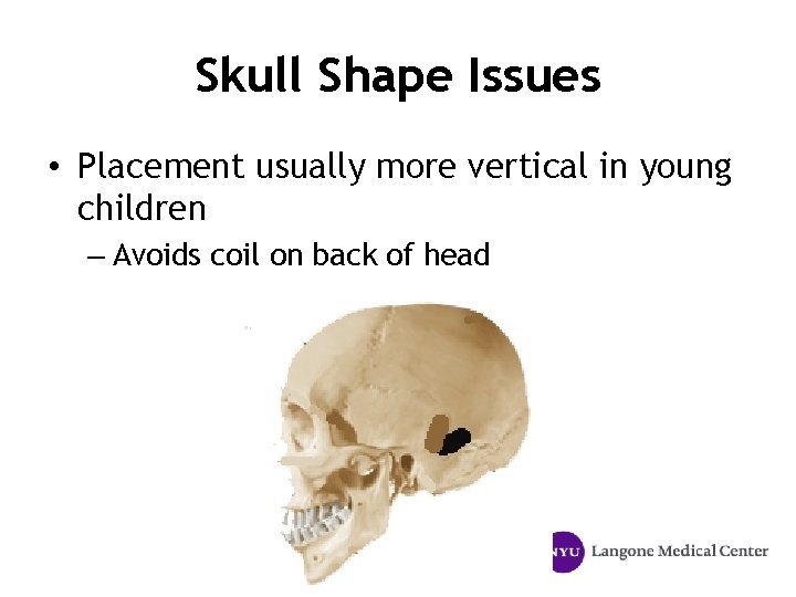 Skull Shape Issues • Placement usually more vertical in young children – Avoids coil