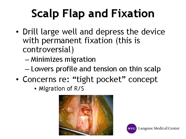 Scalp Flap and Fixation • Drill large well and depress the device with permanent