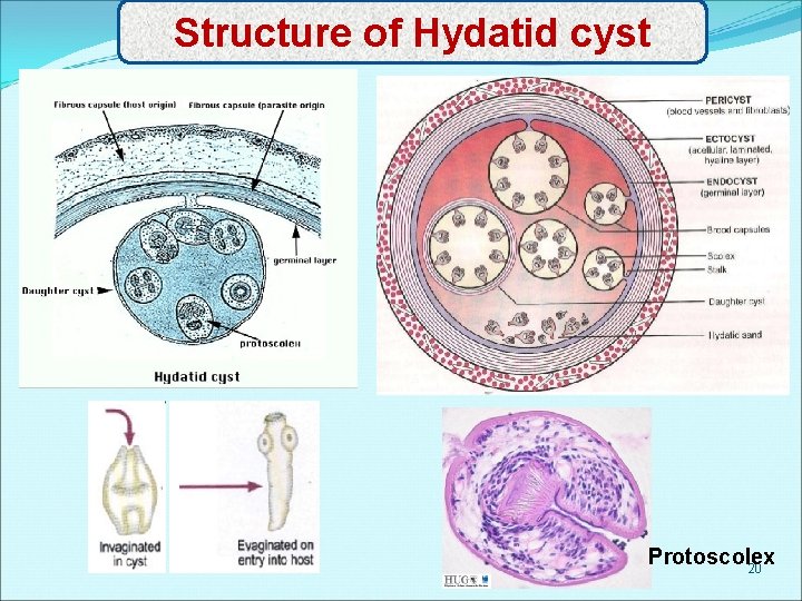 Structure of Hydatid cyst Protoscolex 20 