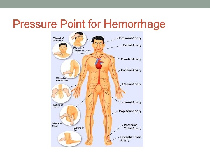 Pressure Point for Hemorrhage 