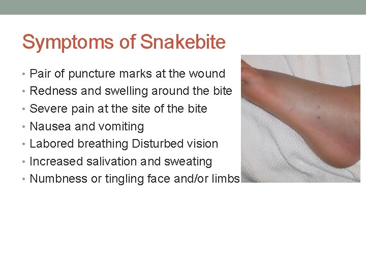 Symptoms of Snakebite • Pair of puncture marks at the wound • Redness and