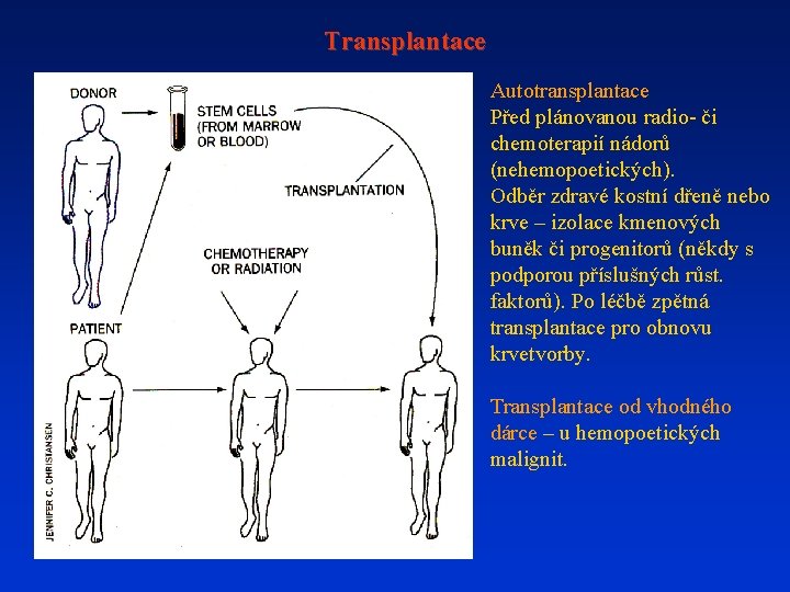 Transplantace Autotransplantace Před plánovanou radio- či chemoterapií nádorů (nehemopoetických). Odběr zdravé kostní dřeně nebo Transplantace Autotransplantace Před plánovanou radio- či chemoterapií nádorů (nehemopoetických). Odběr zdravé kostní dřeně nebo