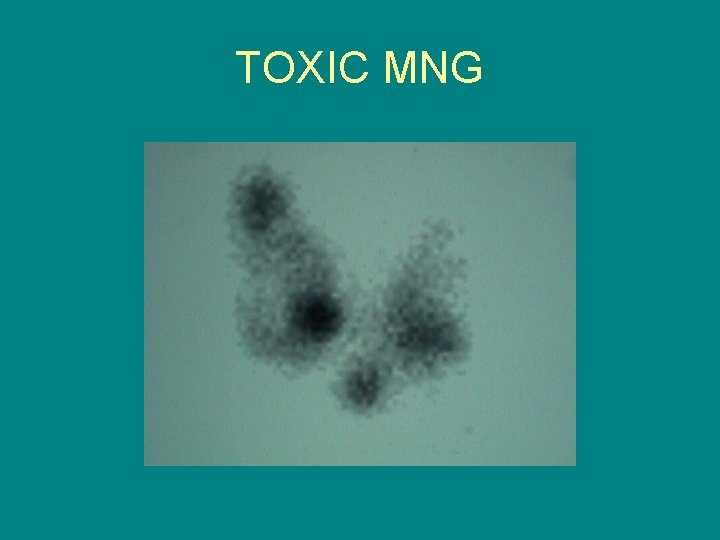 TOXIC MNG 