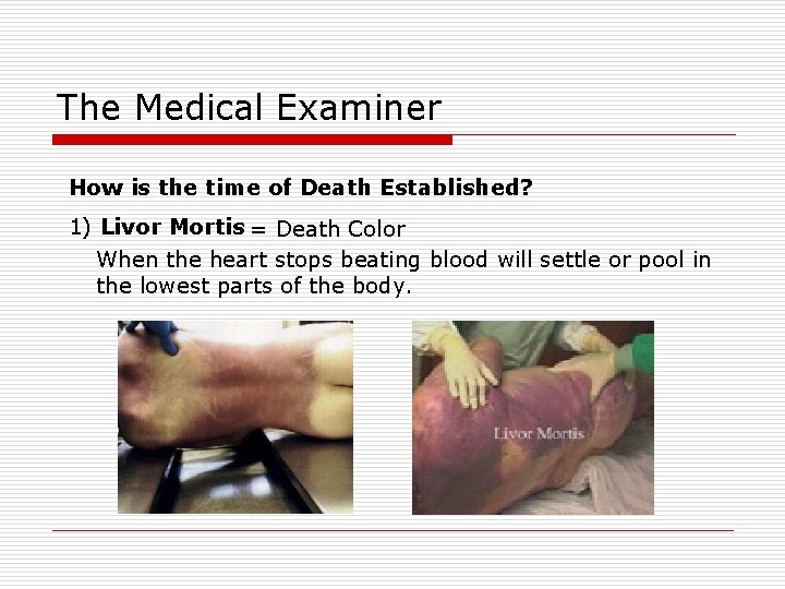 The Medical Examiner How is the time of Death Established? 1) Livor Mortis =