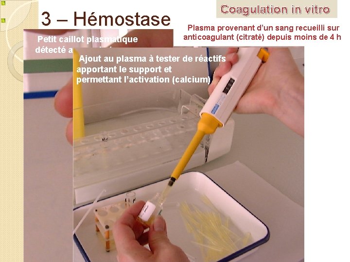 3 – Hémostase Coagulation in vitro Plasma provenant d’un sang recueilli sur anticoagulant (citraté)