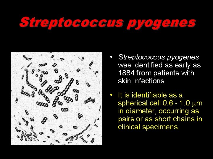 Streptococcus pyogenes • Streptococcus pyogenes was identified as early as 1884 from patients with