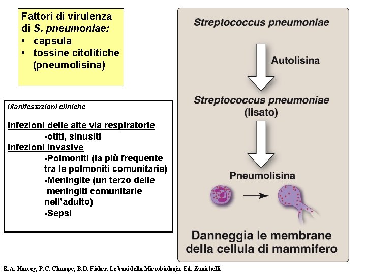 Fattori di virulenza di S. pneumoniae: • capsula • tossine citolitiche (pneumolisina) Manifestazioni cliniche