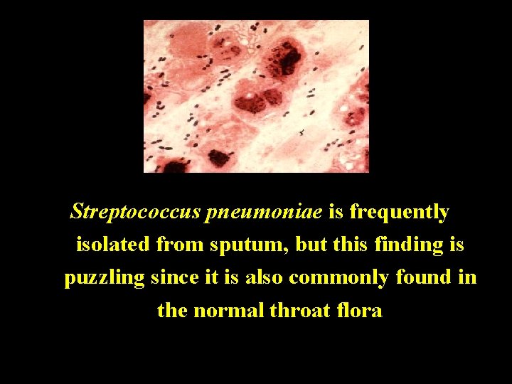 Streptococcus pneumoniae is frequently isolated from sputum, but this finding is puzzling since it