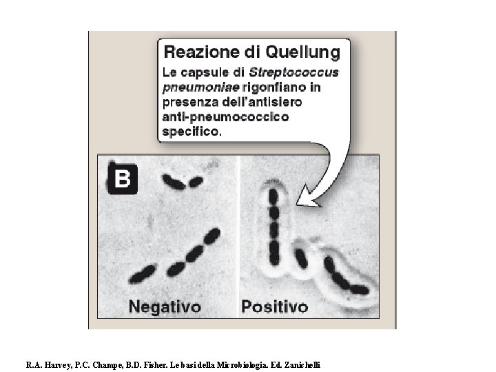 R. A. Harvey, P. C. Champe, B. D. Fisher. Le basi della Microbiologia. Ed.