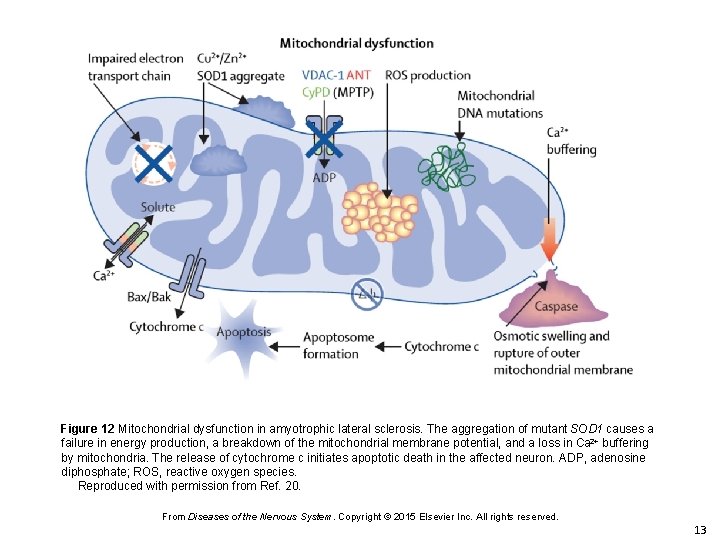 Figure 12 Mitochondrial dysfunction in amyotrophic lateral sclerosis. The aggregation of mutant SOD 1