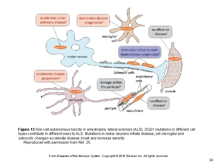 Figure 13 Non-cell-autonomous toxicity in amyotrophic lateral sclerosis (ALS). SOD 1 mutations in different
