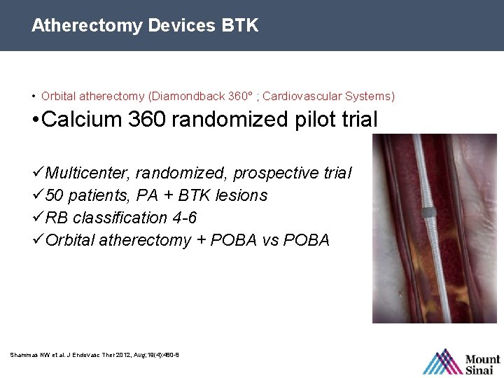 Atherectomy Devices BTK • Orbital atherectomy (Diamondback 360° ; Cardiovascular Systems) • Calcium 360