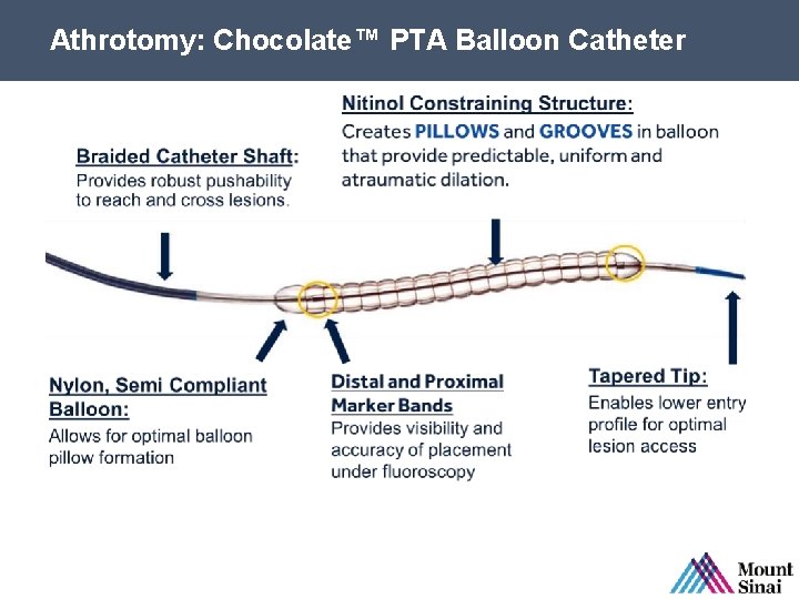 Athrotomy: Chocolate™ PTA Balloon Catheter SPL 61580 Rev. B 