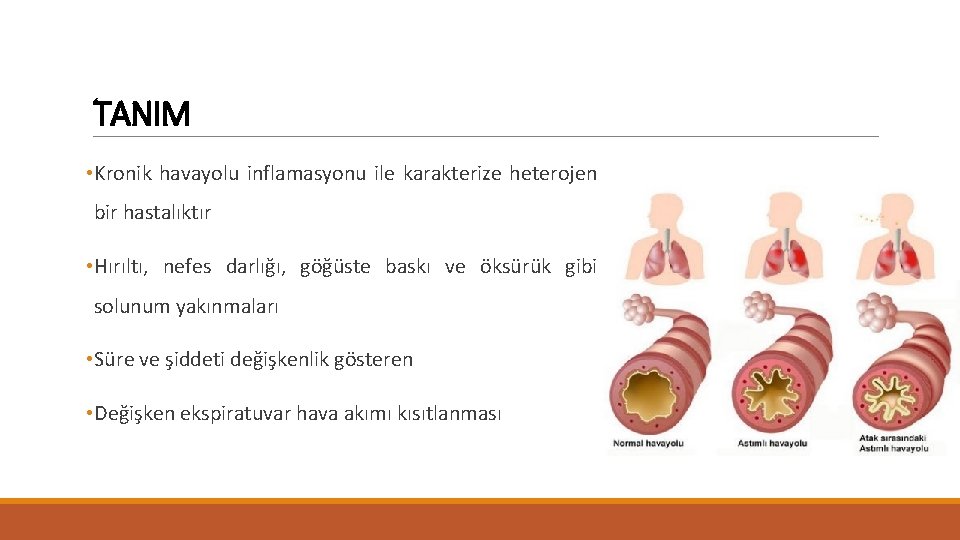 TANIM • Kronik havayolu inflamasyonu ile karakterize heterojen bir hastalıktır • Hırıltı, nefes darlığı,