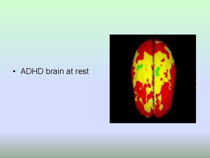  • ADHD brain at rest 