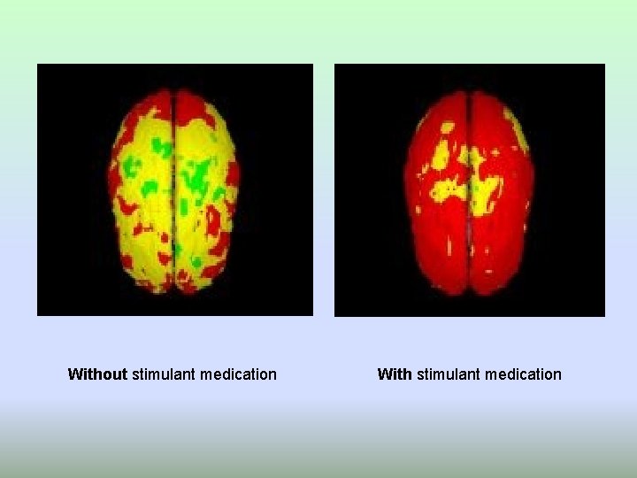 Without stimulant medication With stimulant medication 