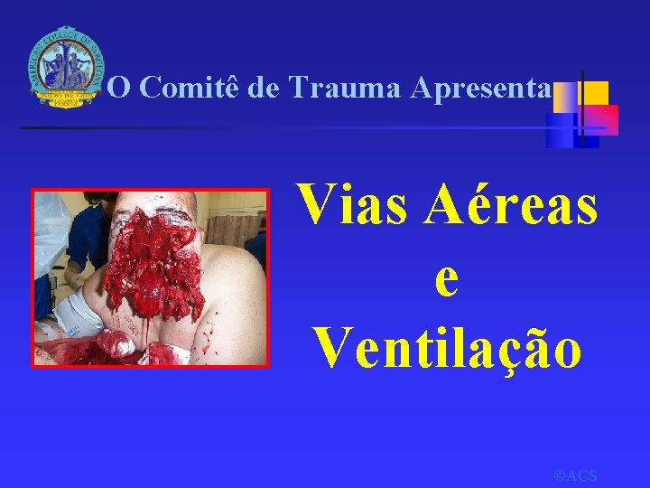 O Comitê de Trauma Apresenta Vias Aéreas e Ventilação ACS 