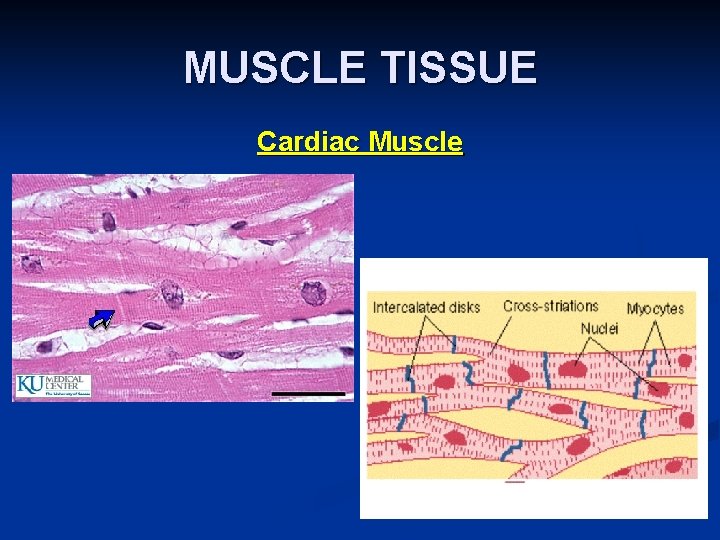 MUSCLE TISSUE Cardiac Muscle 