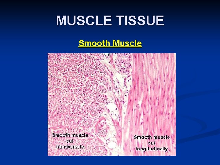 MUSCLE TISSUE Smooth Muscle 