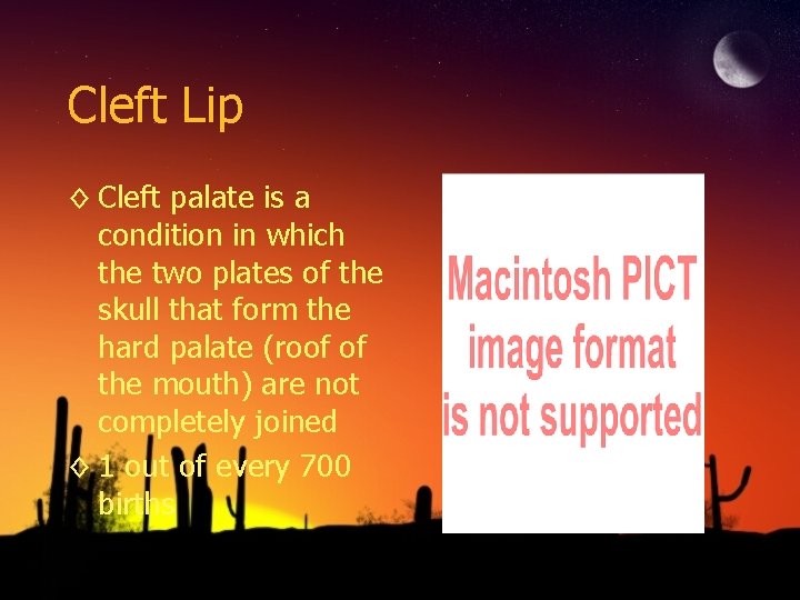 Cleft Lip ◊ Cleft palate is a condition in which the two plates of Cleft Lip ◊ Cleft palate is a condition in which the two plates of