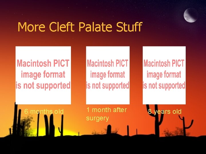 More Cleft Palate Stuff 6 months old 1 month after surgery 8 years old More Cleft Palate Stuff 6 months old 1 month after surgery 8 years old