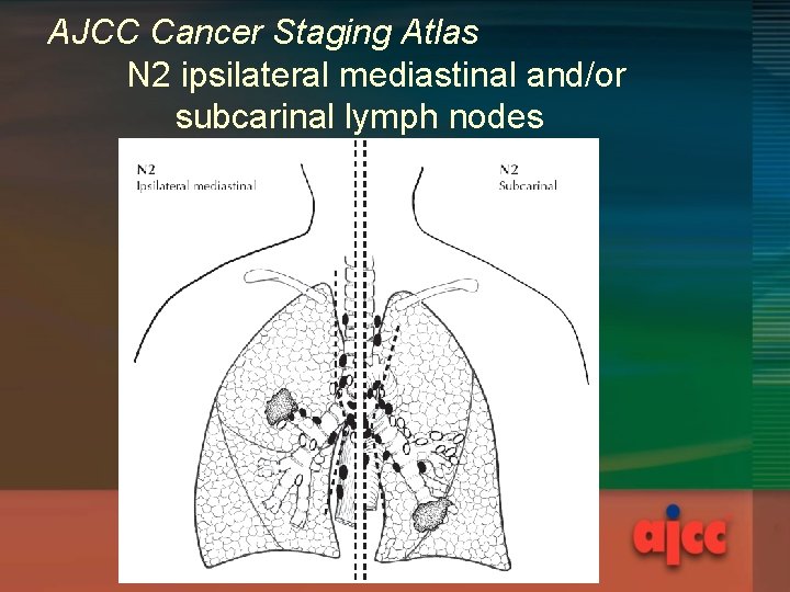 AJCC Cancer Staging Atlas N 2 ipsilateral mediastinal and/or subcarinal lymph nodes 