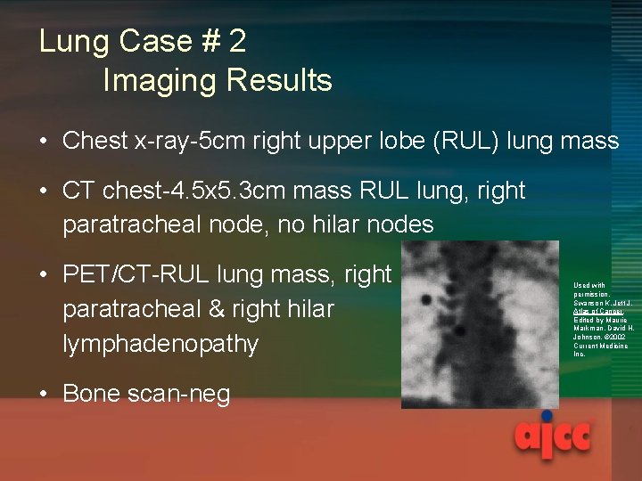 Lung Case # 2 Imaging Results • Chest x-ray-5 cm right upper lobe (RUL)