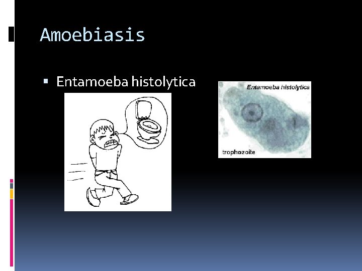 Amoebiasis Entamoeba histolytica 