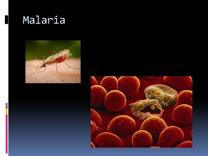 Malaria 