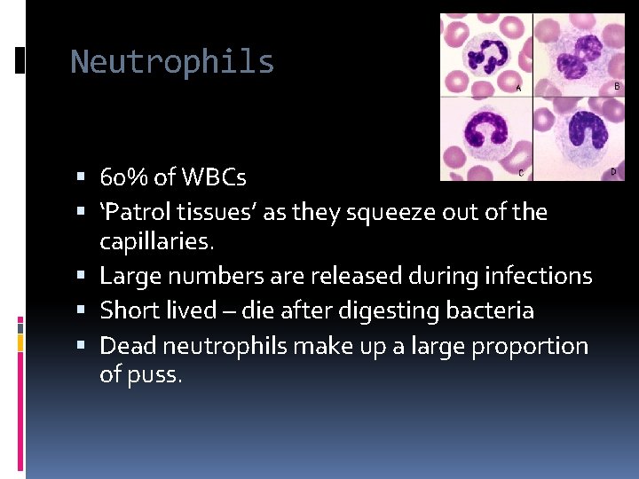Neutrophils 60% of WBCs ‘Patrol tissues’ as they squeeze out of the capillaries. Large