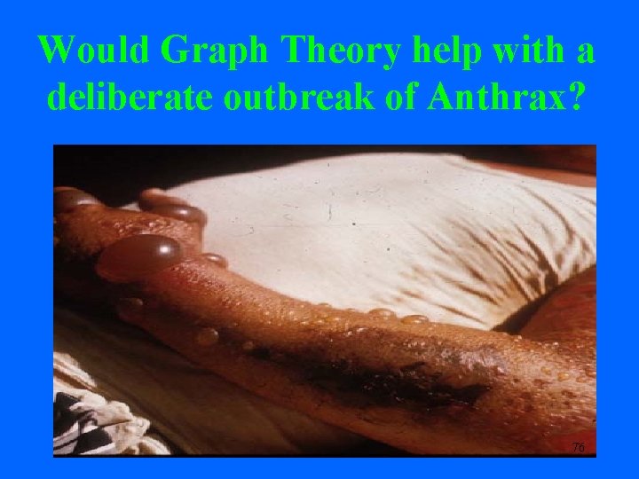 Would Graph Theory help with a deliberate outbreak of Anthrax? 76 