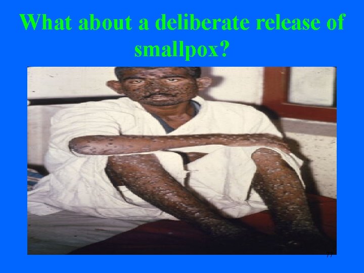 What about a deliberate release of smallpox? 77 