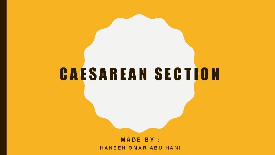 CAESAREAN SECTION MADE BY : HANEEN OMAR ABU HANI 