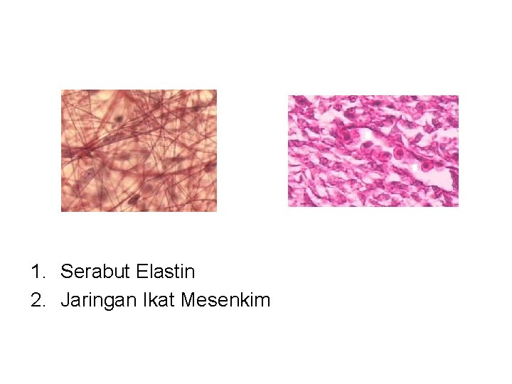 1. Serabut Elastin 2. Jaringan Ikat Mesenkim 