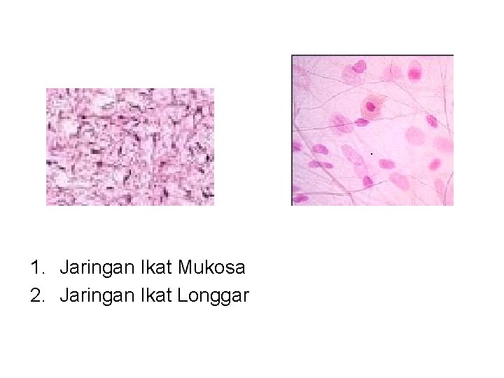 1. Jaringan Ikat Mukosa 2. Jaringan Ikat Longgar 